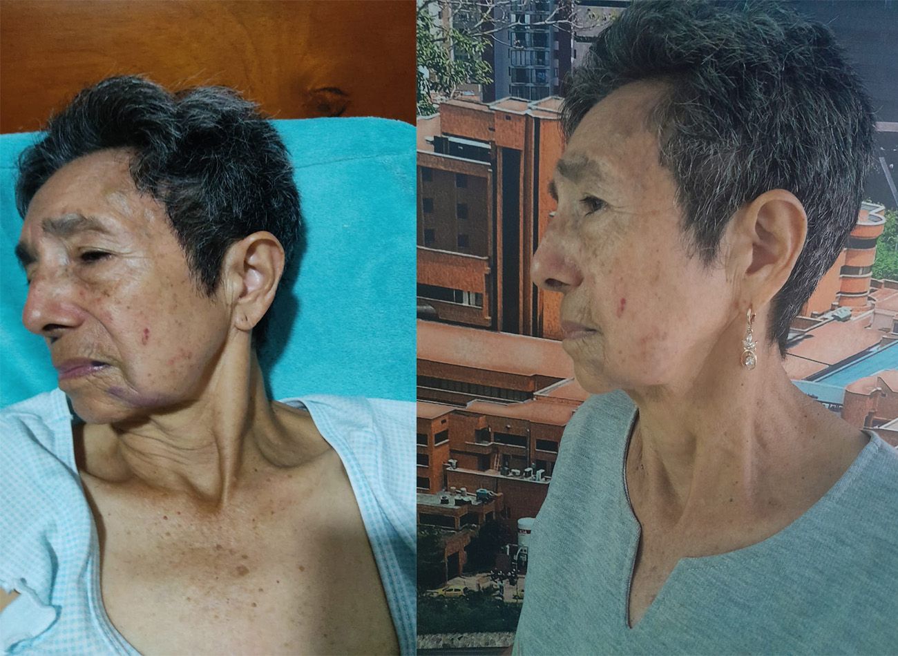 Adulta mayor fue arrojada de vehículo en movimiento tras resistirse a un secuestro