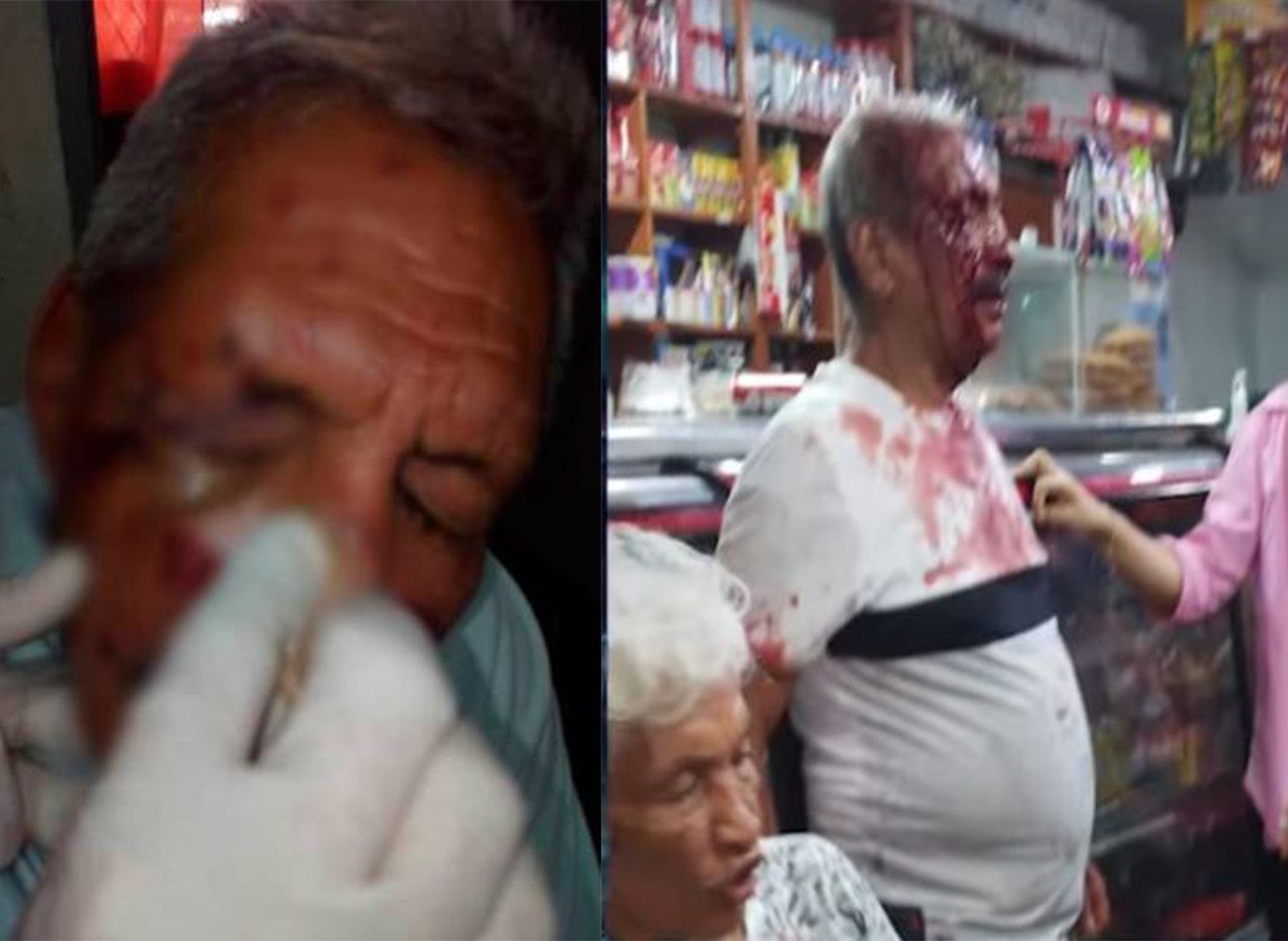 Adulto mayor fue atacado a botellazos en Bucaramanga