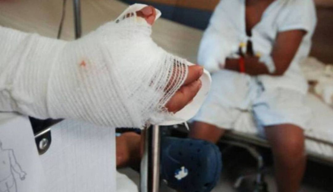 El país llegó a la cifra de 100 menores quemados con pólvora