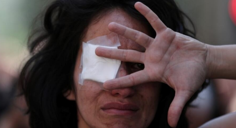 Tema de agresiones a jóvenes de la primera línea regresó a análisis en el Congreso