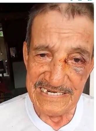 Desadaptados golpearon a un adulto mayor por robarlo en Barrancabermeja