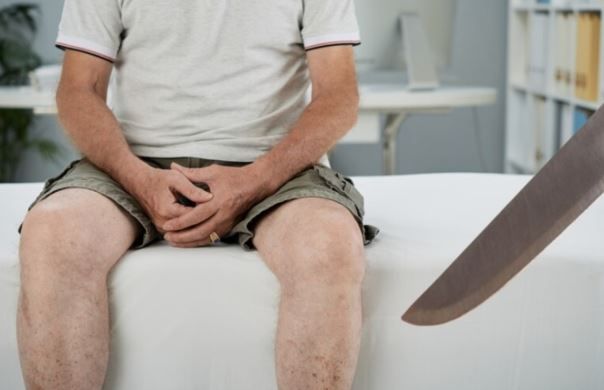 Mujer cortó genitales de su pareja al sospecharle infidelidad