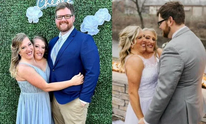 Una de las siamesas mas famosas del mundo contrajo matrimonio