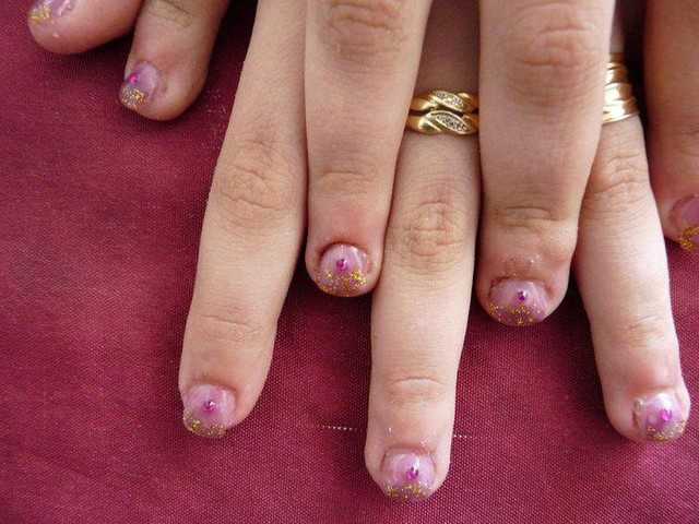 Fue a hacerse la manicura y terminó contagiada con herpes