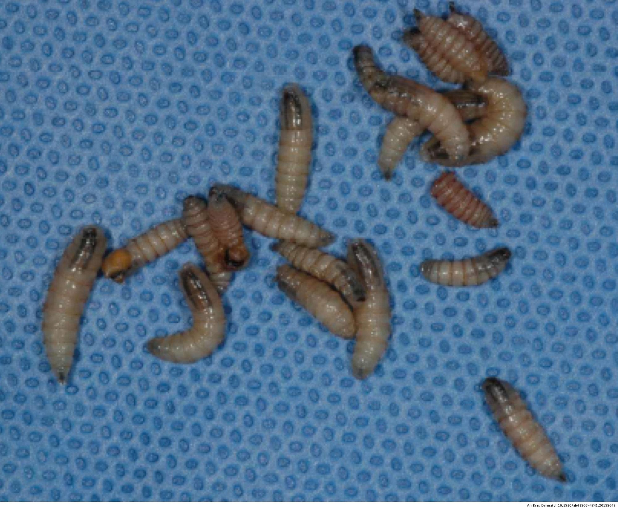 Gusano barrenador mata a una mujer de 19 años