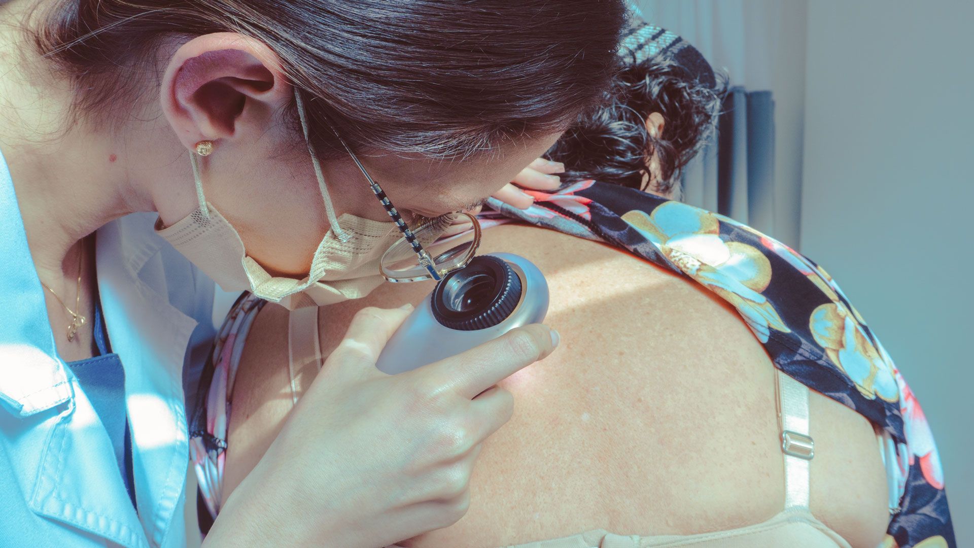 Alerta para Santander: El 15% de los diagnósticos de cáncer en el HIC son de piel