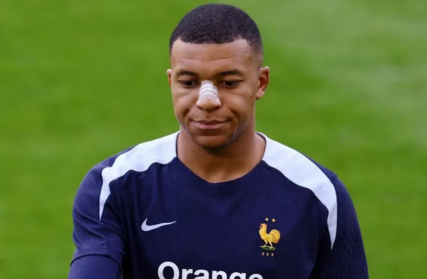 Mbappé casi listo para usar máscara en la Euro