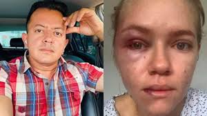 Este es el concejal que anda en graves líos por pegarle a su esposa