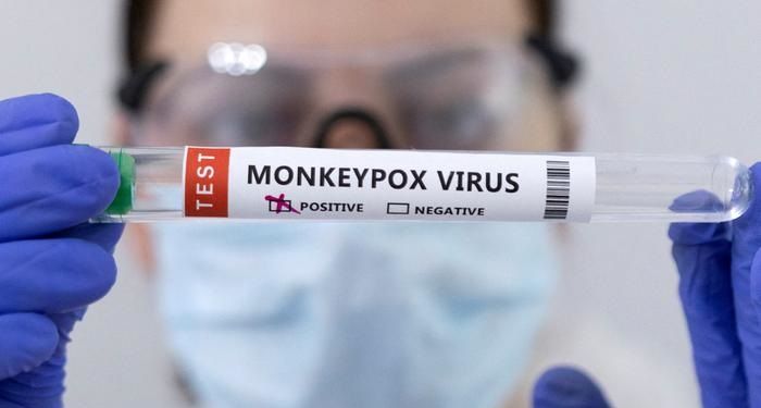 Expertos UDES abordan medidas de protección y datos claves de la viruela del mono