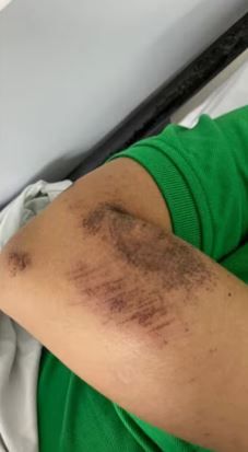 Viaje en moto por aplicación se convirtió en tortura para una mujer en Floridablanca