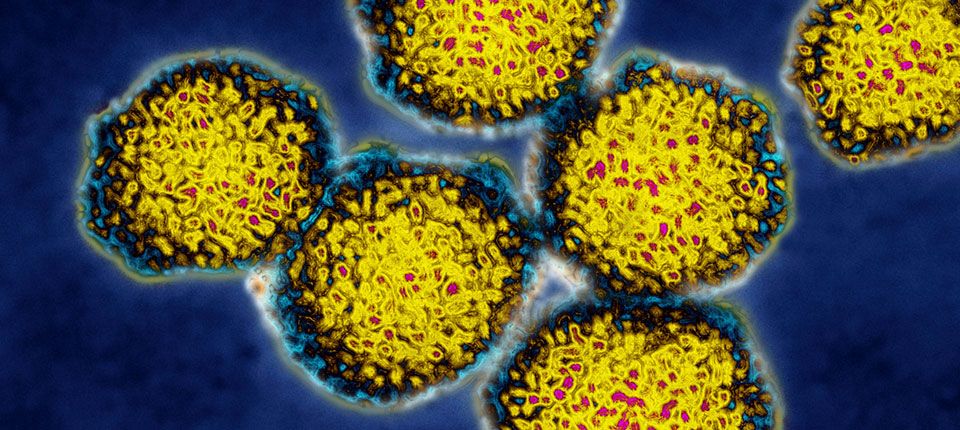 Búsqueda de virus avanza en Colombia: ¿Cómo adelantarse a posibles brotes de enfermedades?