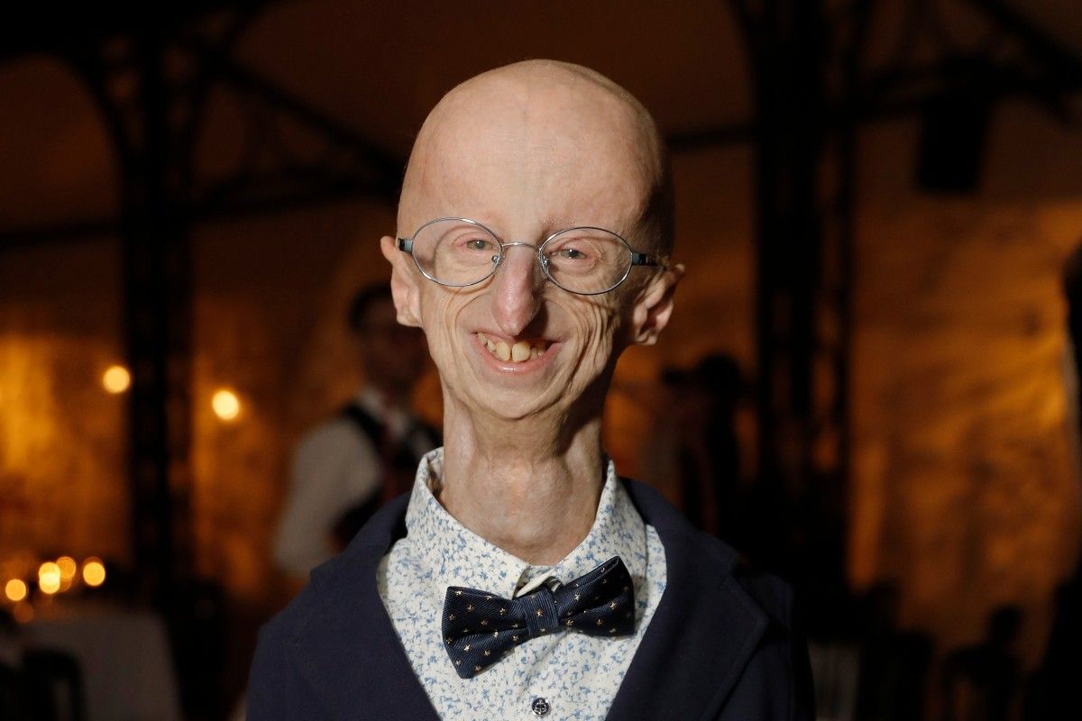 Fallece Sammy Basso, el joven científico que desafió la progeria y vivió 28 años