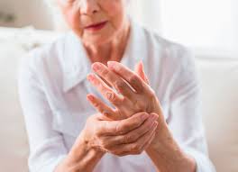 Llega a Colombiaun avance que marca el inicio de la medicina personalizada en artritis reumatoide