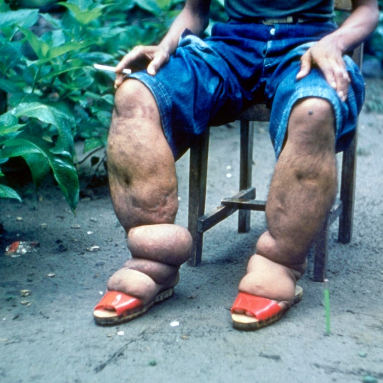 Bogotá será la sede del primer gran encuentro nacional sobre enfermedades raras: Congreso RAREMED 2025