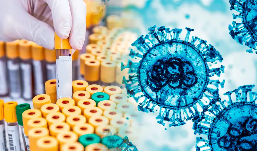 Alerta máxima por desaparición de muestras de virus de alta peligrosidad