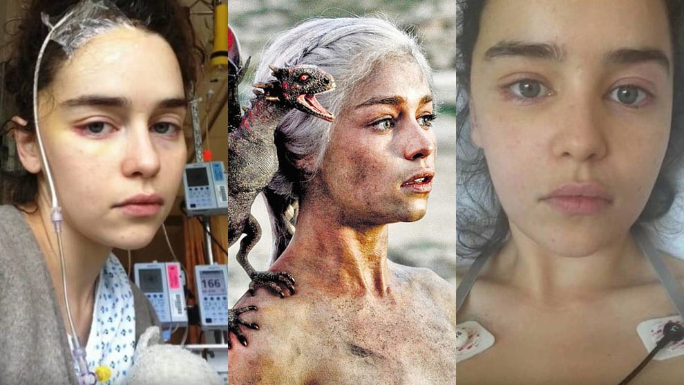 Emilia Clarke revela el duro impacto emocional y físico que dejaron los aneurismas que sufrió durante “Game of Thrones”