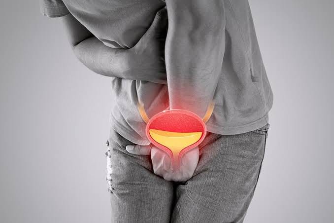 Hasta el 18 % de los hombres en Colombia padecen vejiga hiperactiva y muchos desconocen sus síntomas