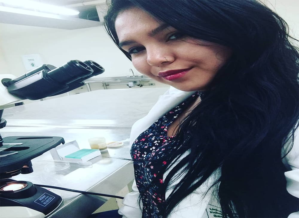 Joven parrillera perdió la vida tras  agonizar una semana por accidente imagen de la publicación