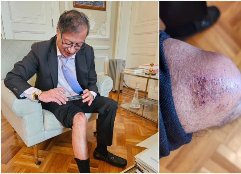 Por una ‘raspadita’ Petro canceló su agenda en el Chocó imagen de la publicación