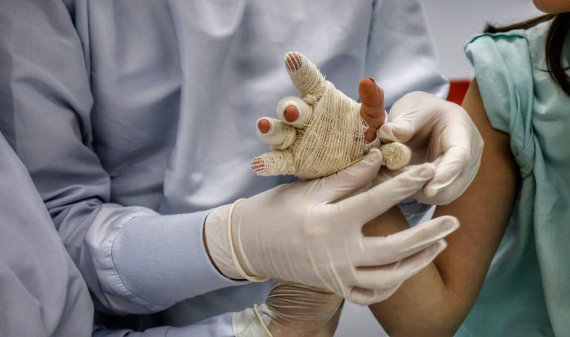 Ya van 15 quemados con pólvora en Santander imagen de la publicación