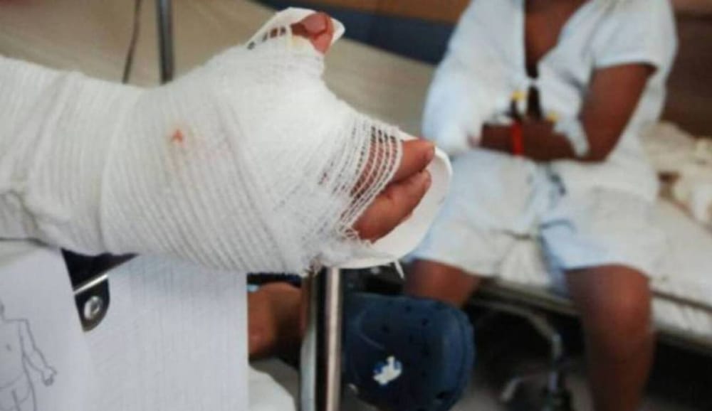 El país llegó a la cifra de 100 menores quemados con pólvora imagen de la publicación