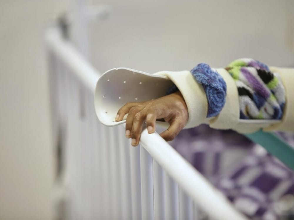 Santander reportó ocho quemados por pólvora en año nuevo imagen de la publicación