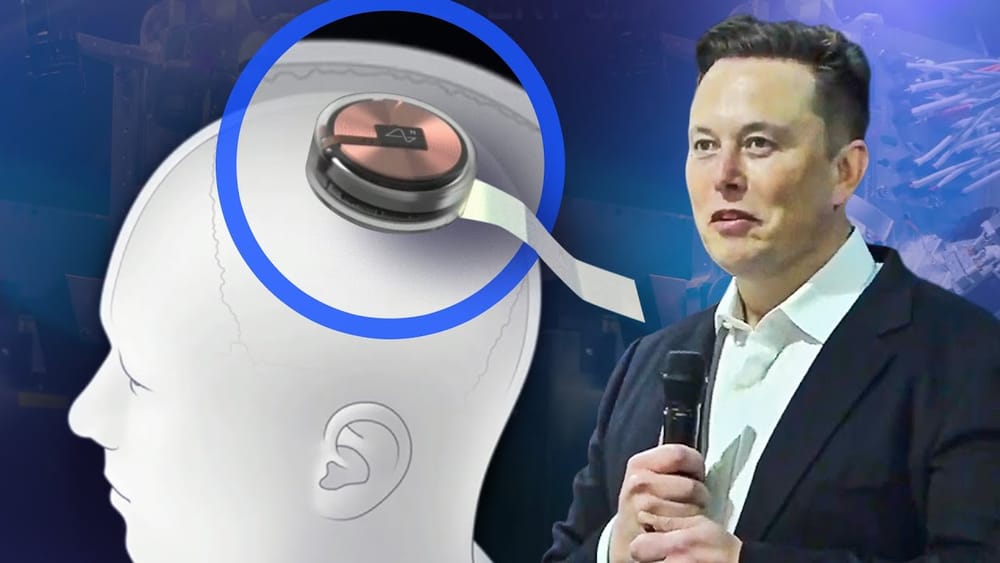 Telepathy el chip cerebral de Neuralink imagen de la publicación