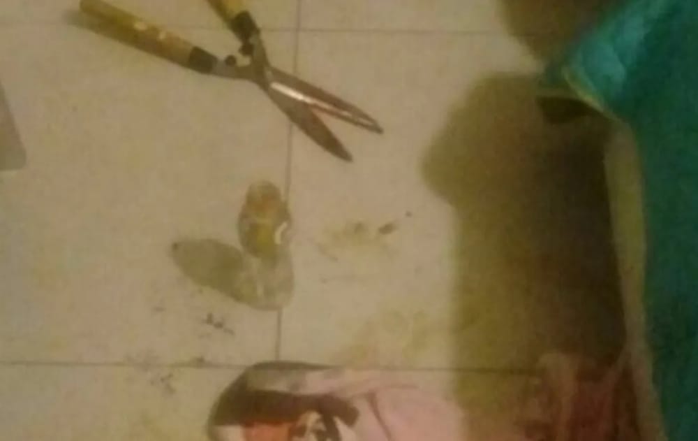 Por infidelidad le cortaron el miembro a Iván Céspedes imagen de la publicación