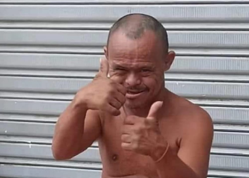 Asesinado a pedradas reconocido habitante de calle con síndrome de down imagen de la publicación