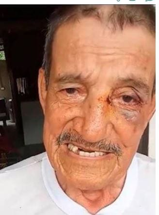 Desadaptados golpearon a un adulto mayor por robarlo en Barrancabermeja imagen de la publicación