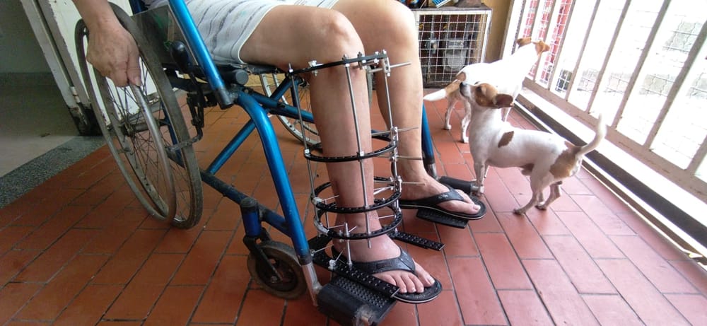 Mujer podría perder la pierna por aparente negligencia médica imagen de la publicación