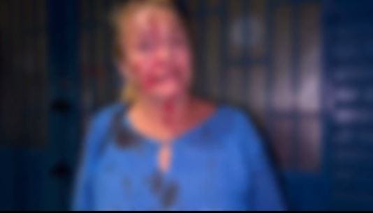 Desadaptado apuñaló sin piedad a su pareja en Bucaramanga imagen de la publicación