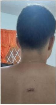 'Picadito' de fútbol entre niños de Piedecuesta acabó con un menor apuñalado imagen de la publicación