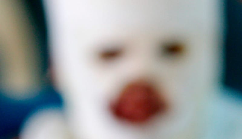 Mujer fue quemada presuntamente por su pareja sentimental imagen de la publicación