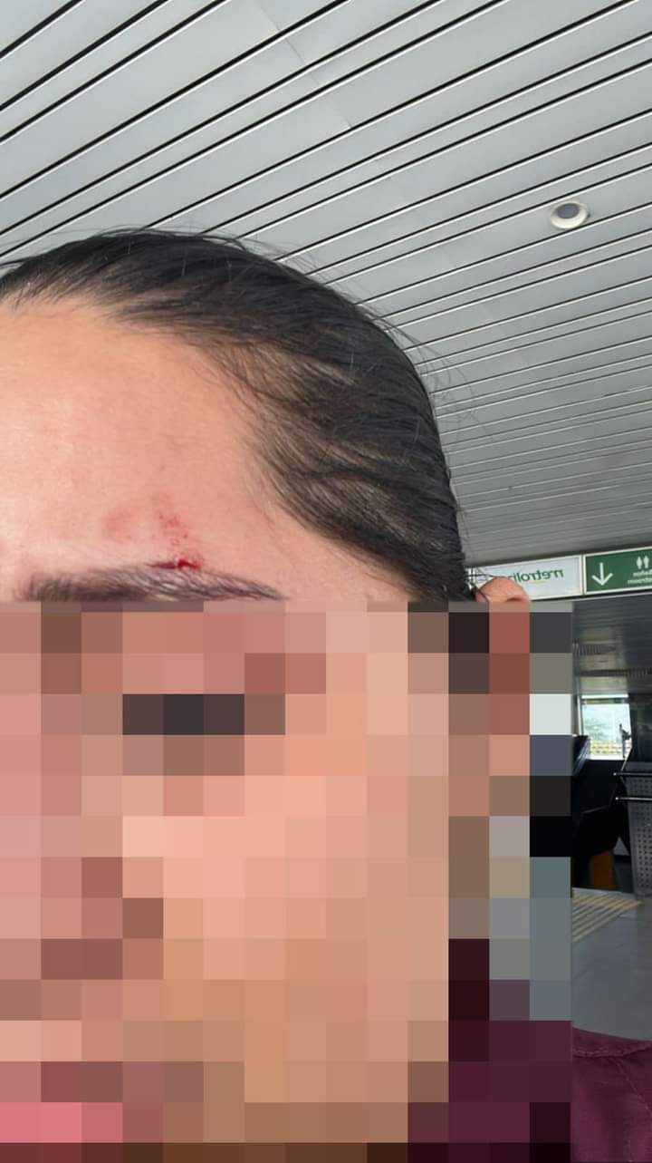 Colado se ofendió con una vigilante en estación de Metrolínea y la agredió imagen de la publicación