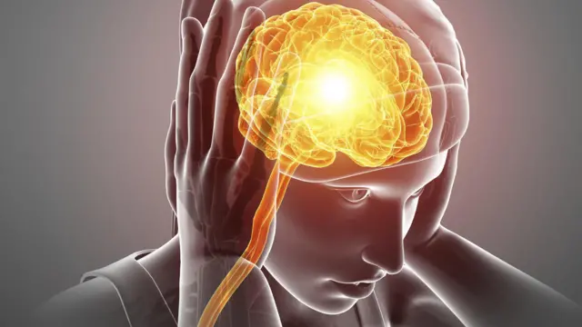 La migraña y su impacto en la salud mental imagen de la publicación