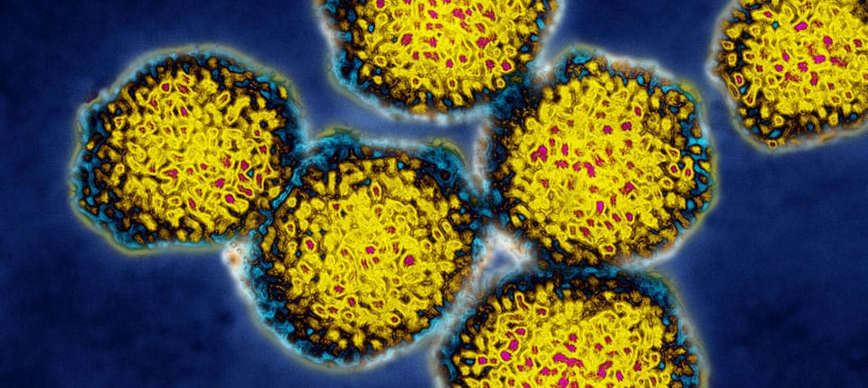 Búsqueda de virus avanza en Colombia: ¿Cómo adelantarse a posibles brotes de enfermedades? imagen de la publicación