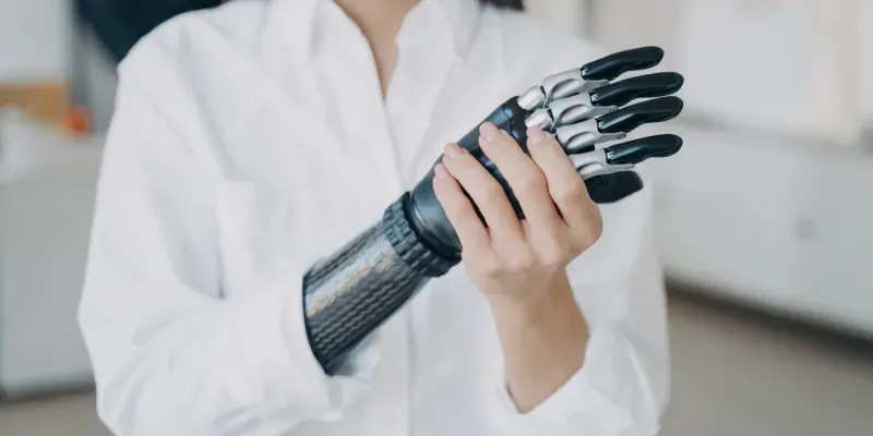 Convocatoria en Cundinamarca para Prótesis Gratuitas imagen de la publicación