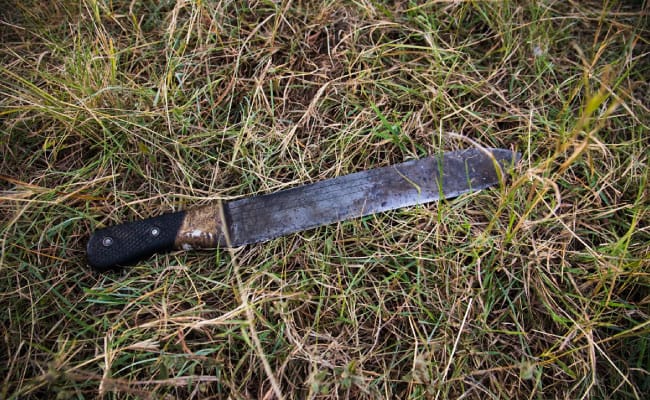 ¡Desgarrador! mujer de 50 años fue atacada con machete por su exesposo en Landázuri imagen de la publicación