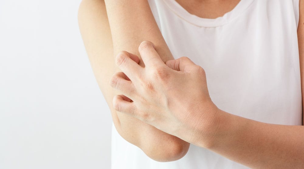 Picazón persistente: un problema común que merece atención médica imagen de la publicación