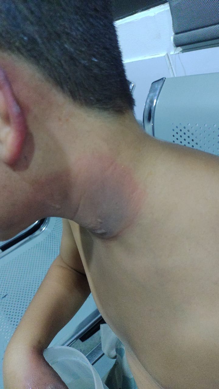 Irresponsables con pólvora generaron caos en Floridablanca imagen de la publicación