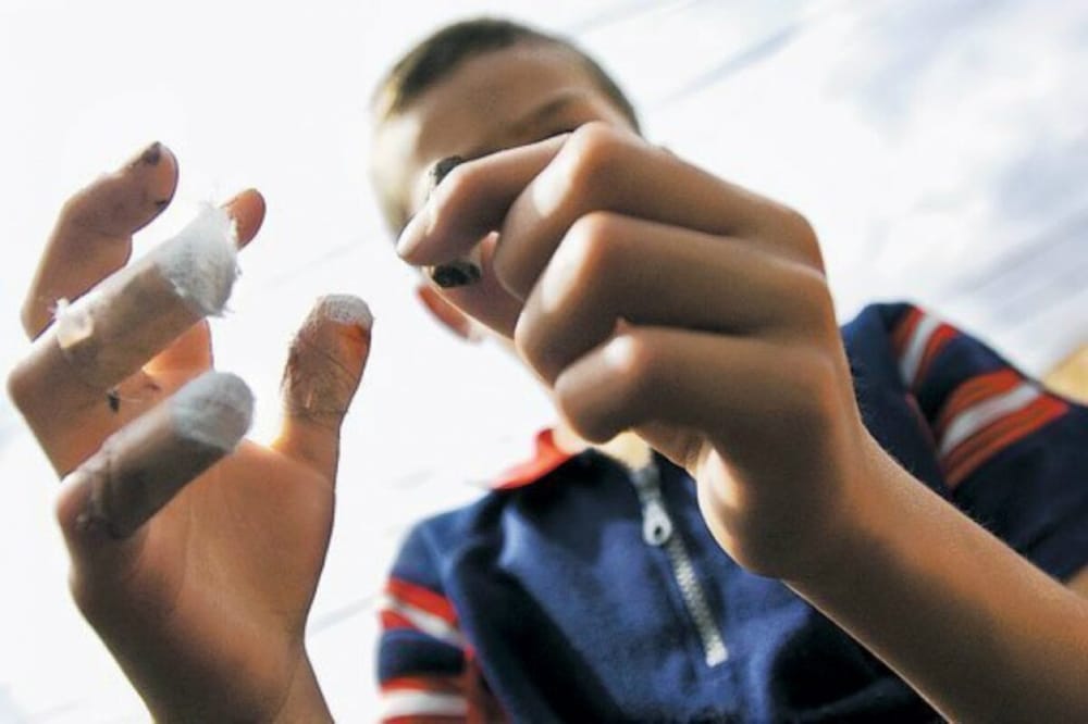 Diciembre y los peligros de las quemaduras imagen de la publicación