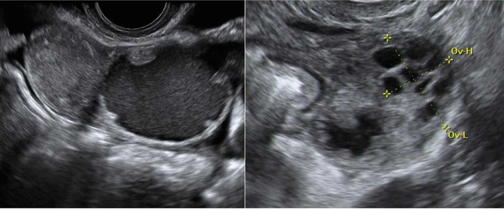 Influencer pensó que tenía cólicos y murió por un absceso ovárico imagen de la publicación