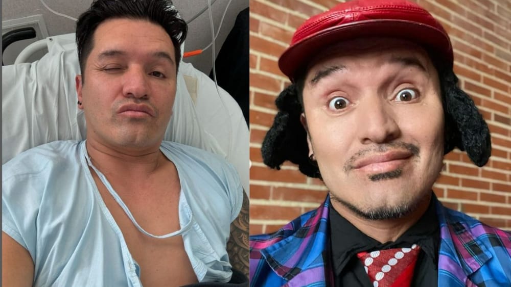 Hassam enfrenta nuevo problema de salud tras luchar contra el cáncer imagen de la publicación