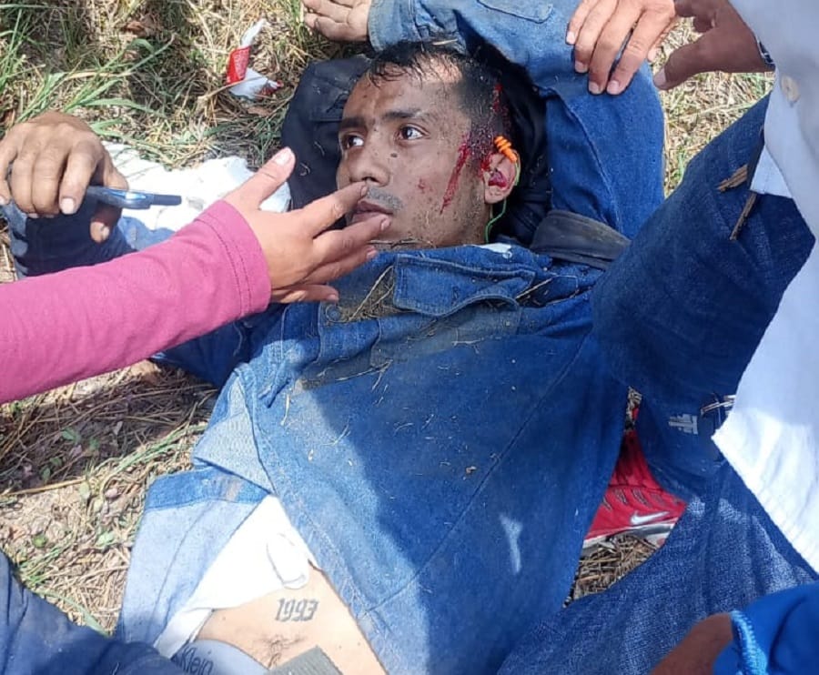 Grave accidente de motocicleta en la rotonda de El Palenque en Bucaramanga imagen de la publicación