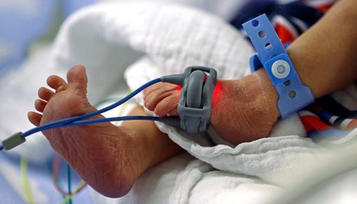 Bebé queda atorado en molino de carne y pierde una mano imagen de la publicación