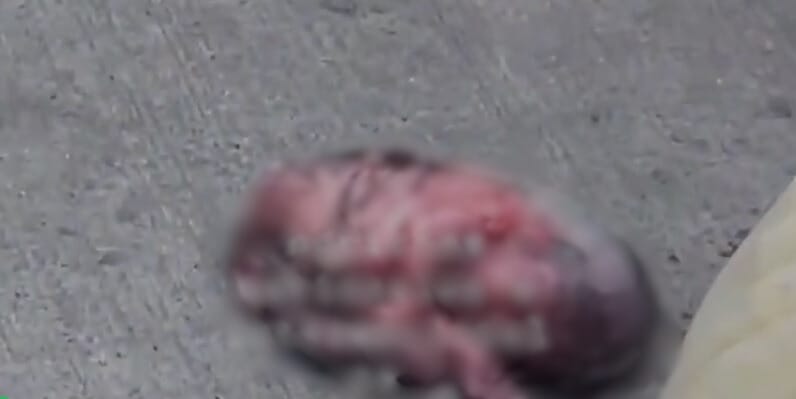 VIDEO. Perro fue visto con un feto humano en sus dientes imagen de la publicación