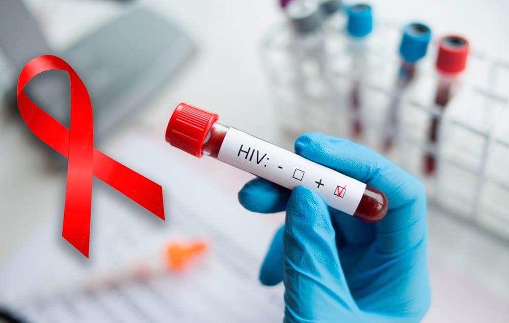 En Colombia 44.000 personas aún no conocen su diagnóstico de VIH imagen de la publicación