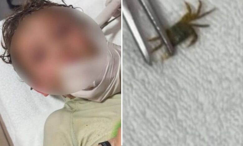 ¡Qué susto!: médicos extraen un cangrejo vivo del oído de un niño imagen de la publicación
