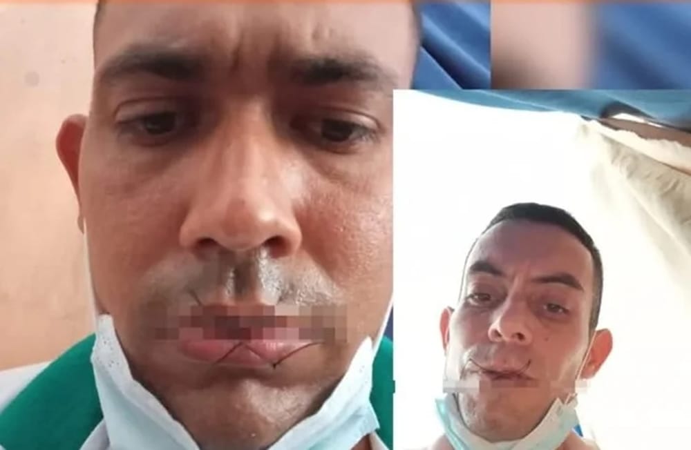 Protesta con bocas cosidas en cárcel de Pologordo en Girón imagen de la publicación